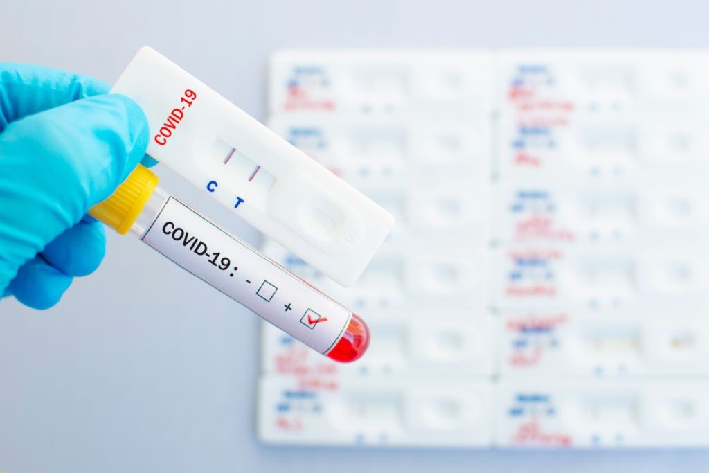 Gamechanger, Abbott to Launch 5-minute COVID-19 Test for Use Anywhere