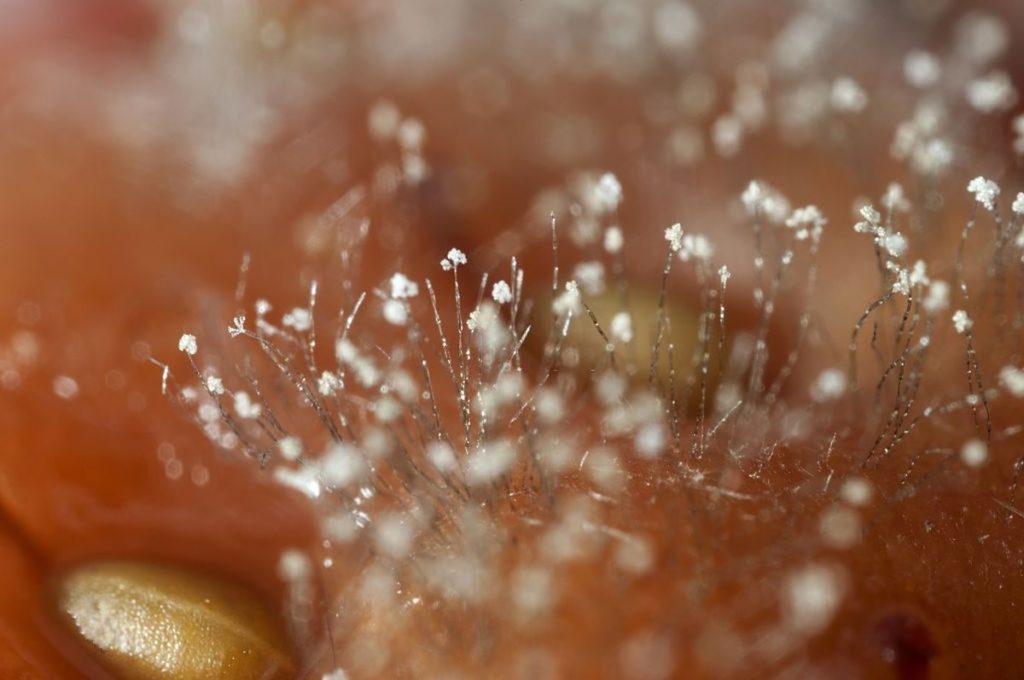 Eyes Of 3 Children Infected With Black Fungus Removed In Mumbai Hospitals